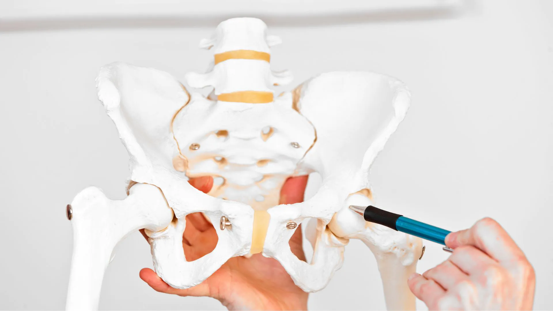 Impingement syndróm bedrového kĺbu